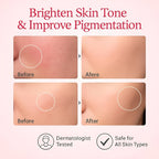 Medicube TXA Niacinamide Serum