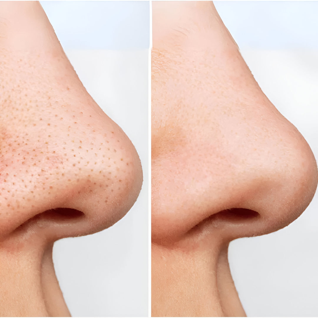 Anua Heartleaf Pore Control Cleansing Oil